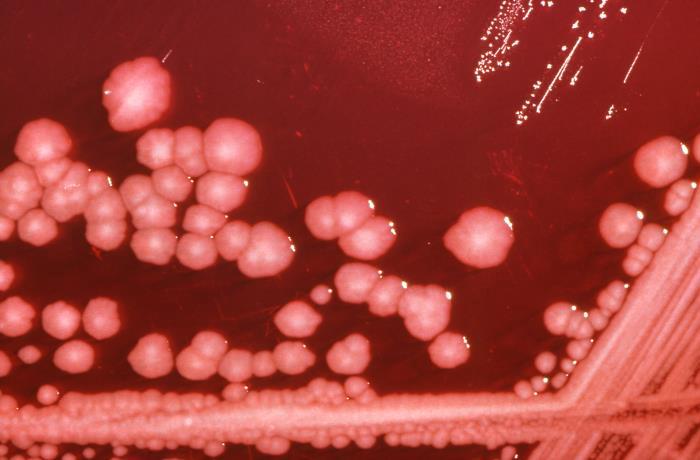 Microscopic view of Proteus mirabilis bacteria in various forms